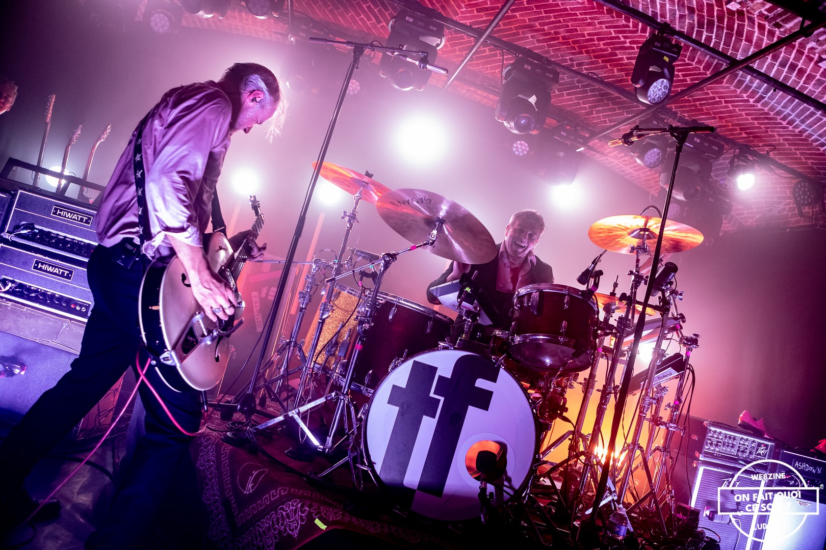 Triggerfinger